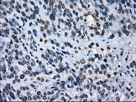 m00388 1 anti ercc1 mouse monoclonal antibody clone id oti1a3 ihc testing 12