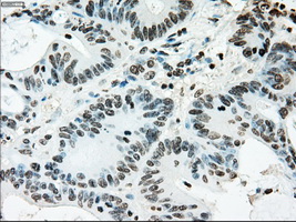 m00388 1 anti ercc1 mouse monoclonal antibody clone id oti1a3 ihc testing 13
