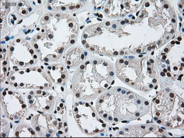 m00388 1 anti ercc1 mouse monoclonal antibody clone id oti1a3 ihc testing 14