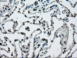 m00388 1 anti ercc1 mouse monoclonal antibody clone id oti1a3 ihc testing 15