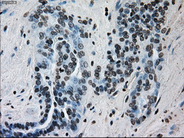 m00388 1 anti ercc1 mouse monoclonal antibody clone id oti1a3 ihc testing 3