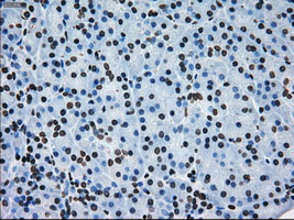 m00388 1 anti ercc1 mouse monoclonal antibody clone id oti1a3 ihc testing 4