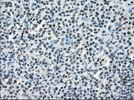 m00388 1 anti ercc1 mouse monoclonal antibody clone id oti1a3 ihc testing 5