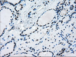 m00388 1 anti ercc1 mouse monoclonal antibody clone id oti1a3 ihc testing 6