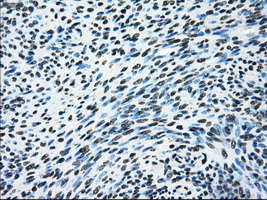 m00388 1 anti ercc1 mouse monoclonal antibody clone id oti1a3 ihc testing 7