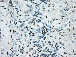 m00388 1 anti ercc1 mouse monoclonal antibody clone id oti1a3 ihc testing 8