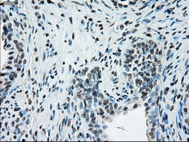 m00388 1 anti ercc1 mouse monoclonal antibody clone id oti1a3 ihc testing 9