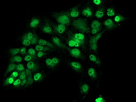 m00388 2 anti ercc1 mouse monoclonal antibody clone id oti1c10 if testing 6