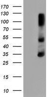 HEK293T cells were transfected with the pCMV6-ENTRY control (Left lane) or pCMV6-ENTRY ERCC1 (Right lane) cDNA for 48 hrs and lysed