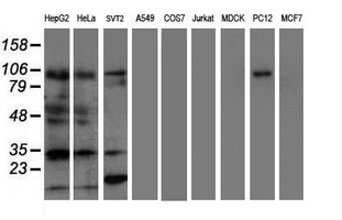 Western blot analysis of extracts (35ug) from 9 different cell lines by using anti-ERCC1 monoclonal antibody (HepG2: human; HeLa: human; SVT2: mouse; A549: human; COS7: monkey; Jurkat: human; MDCK: canine; PC12: rat; MCF7: human)