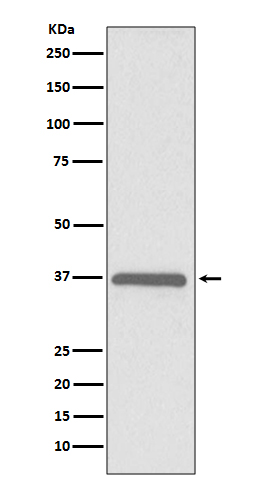 Western blot analysis of ERCC1 expression in HeLa cell lysate
