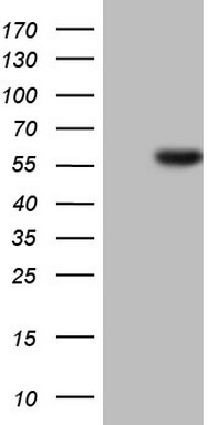 HEK293T cells were transfected with the pCMV6-ENTRY control (Left lane) or pCMV6-ENTRY HNF4A (Right lane) cDNA for 48 hrs and lysed