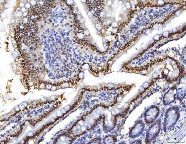  IHC analysis of HNF-4-alpha using anti-HNF-4-alpha antibody (M00389-2)