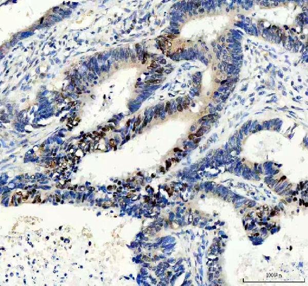 IHC analysis of HNF4A using anti-HNF4A antibody (M00389-3)