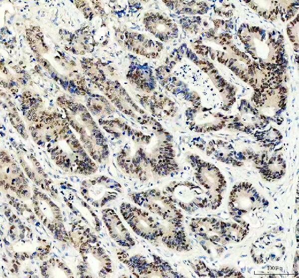 IHC analysis of HNF4A using anti-HNF4A antibody (M00389-3)