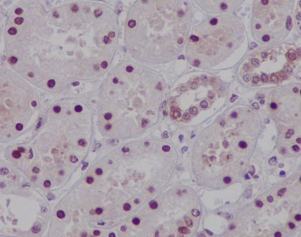 Immunohistochemical analysis of paraffin-embedded human kidney, using HNF-4-alpha Antibody