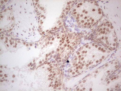 Immunohistochemical staining of paraffin-embedded Human prostate tissue within the normal limits using anti-RARA mouse monoclonal antibody