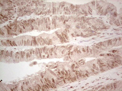 m00392 1 anti retinoic acid receptor alpha rara mouse monoclonal antibody clone id oti2c3 ihc testing 4