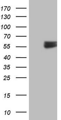 HEK293T cells were transfected with the pCMV6-ENTRY control (Left lane) or pCMV6-ENTRY RARA (Right lane) cDNA for 48 hrs and lysed