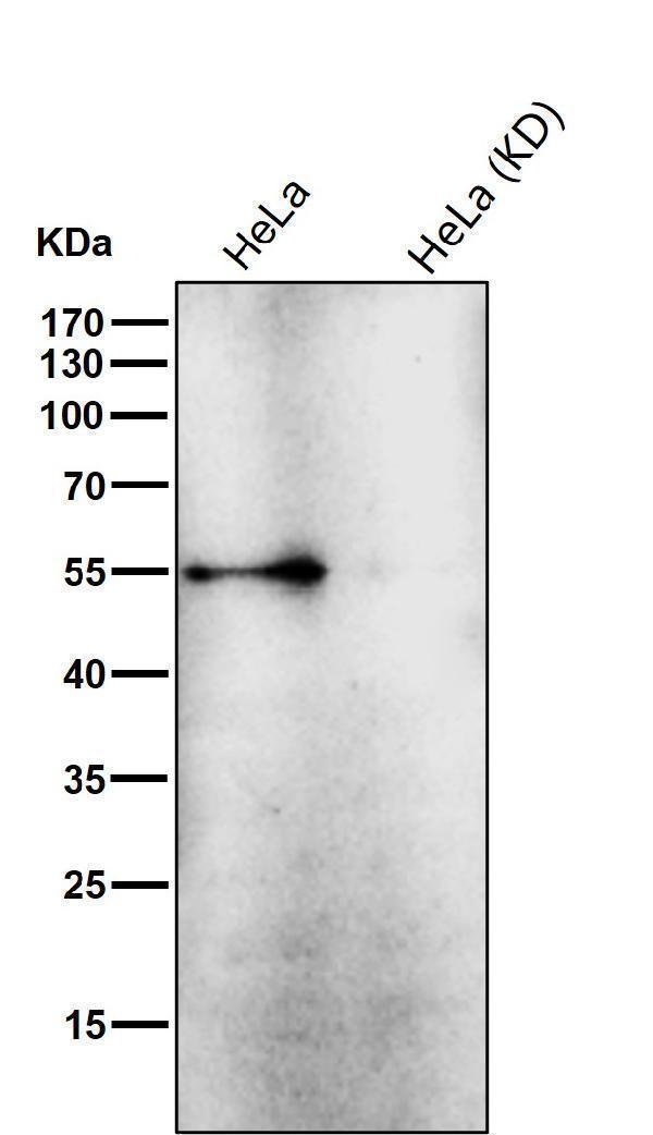 All lanes use the Antibody at 1:1000 dilution for 1 hour at room temperature