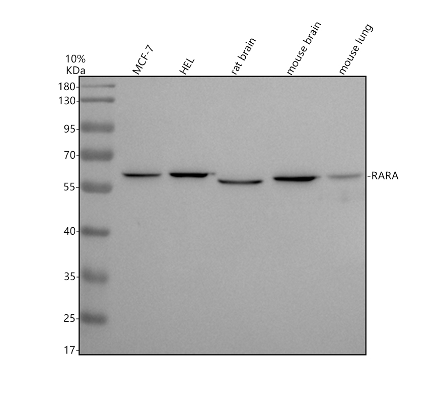 Western blot analysis of RARA using anti-RARA antibody (M00392)
