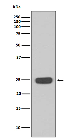 Western blot analysis of Interferon gamma expression in Jurkat cell lysate
