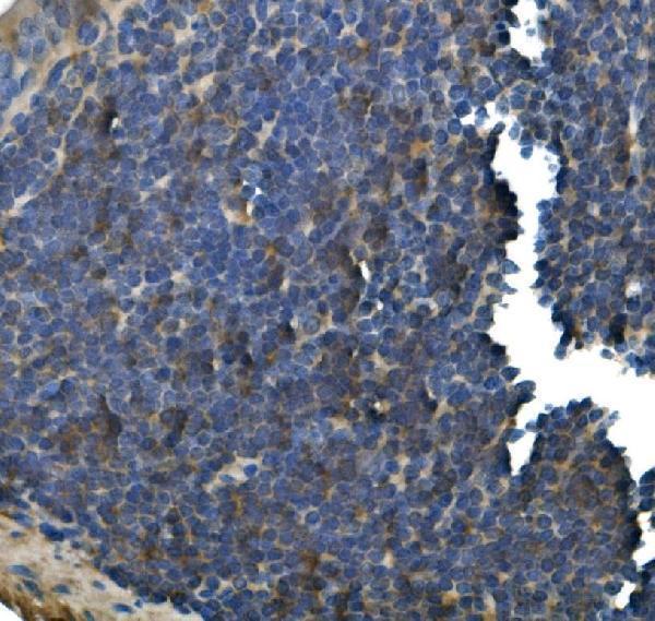  IHC analysis of IFN Gamma using anti-IFN Gamma antibody (M00393-5)