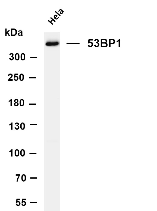 Various whole cell lysates were separated by 4-8% SDS-PAGE, and the membrane was blotted with anti-53BP1 antibody
