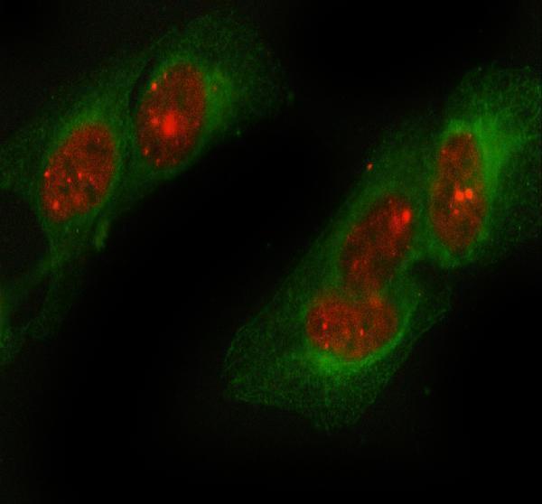 m00397 53bp1 primary antibodies if testing 1