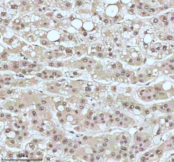m00397 53bp1 primary antibodies ihc testing 11