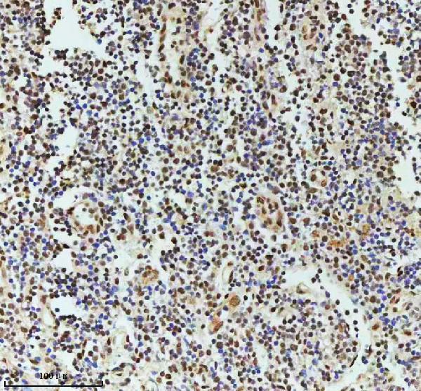 m00397 53bp1 primary antibodies ihc testing 17