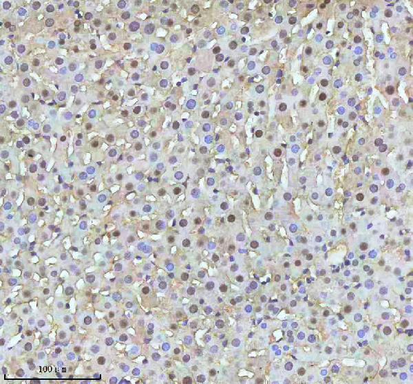 m00397 53bp1 primary antibodies ihc testing 21