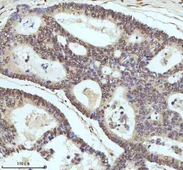 m00397 53bp1 primary antibodies ihc testing 9