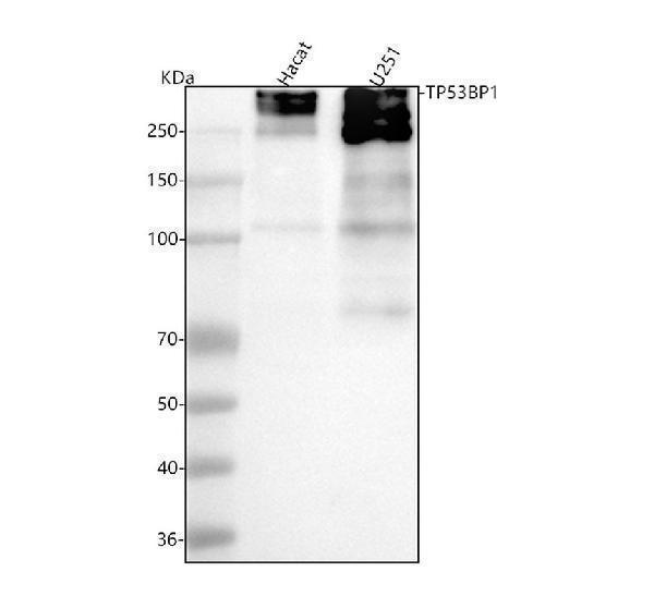 m00397 53bp1 primary antibodies wb testing 1