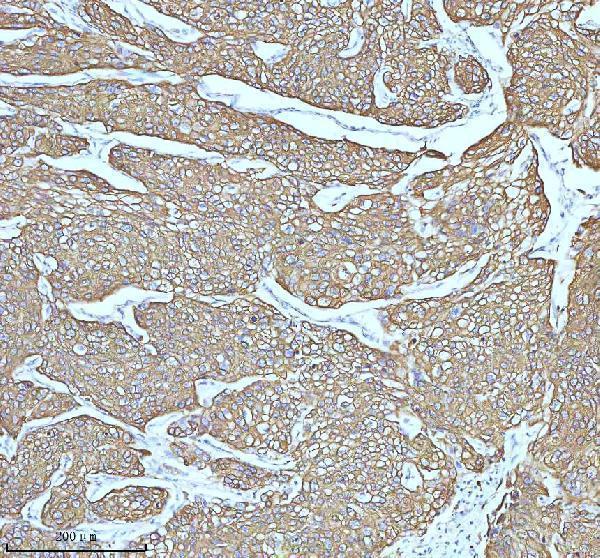 m00398 1 krt5 primary antibodies ihc testing 2_1
