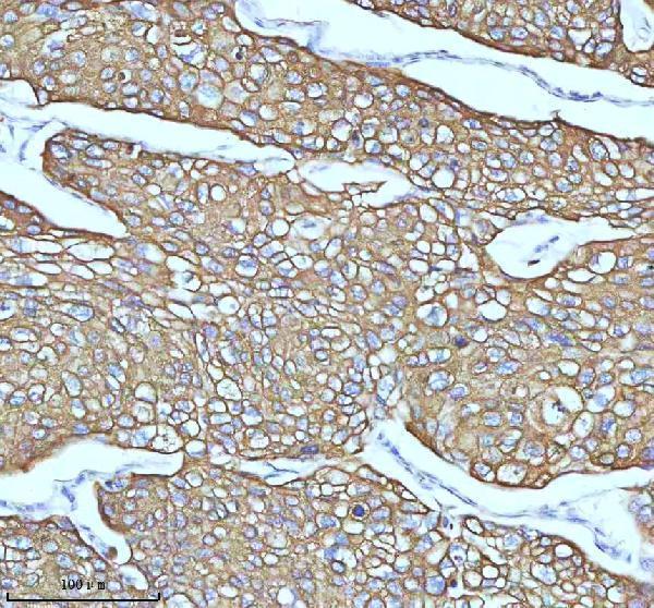 m00398 1 krt5 primary antibodies ihc testing 3_1