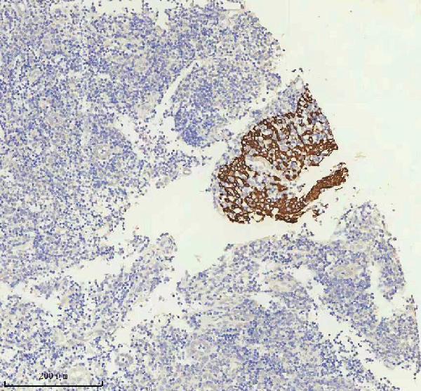 m00398 1 krt5 primary antibodies ihc testing 4_1