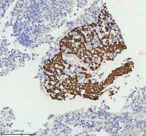 m00398 1 krt5 primary antibodies ihc testing 5_1