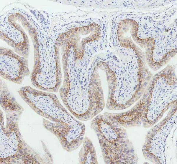 m00398 1 krt5 primary antibodies ihc testing 6_1