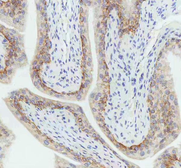 m00398 1 krt5 primary antibodies ihc testing 7_1