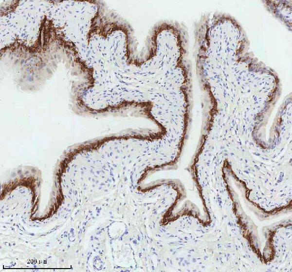 m00398 1 krt5 primary antibodies ihc testing 8_1
