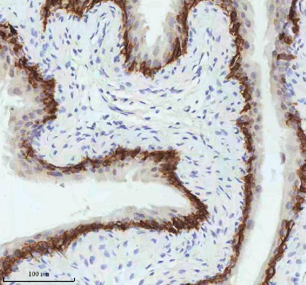 m00398 1 krt5 primary antibodies ihc testing 9_1