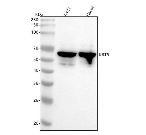  Western blot analysis of KRT5 using anti-KRT5 antibody (M00398-1)