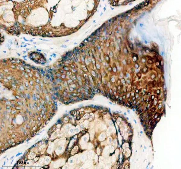 IHC analysis of KRT5 using anti-KRT5 antibody (M00398-2)