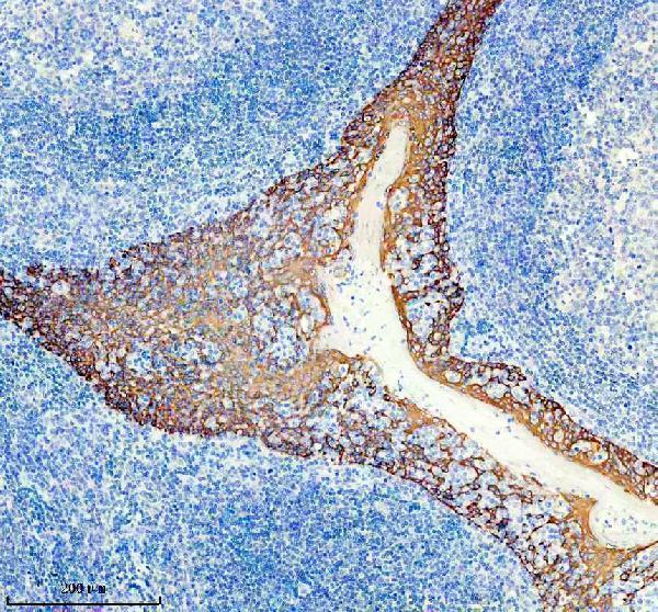 IHC analysis of KRT5 using anti-KRT5 antibody (M00398-2)