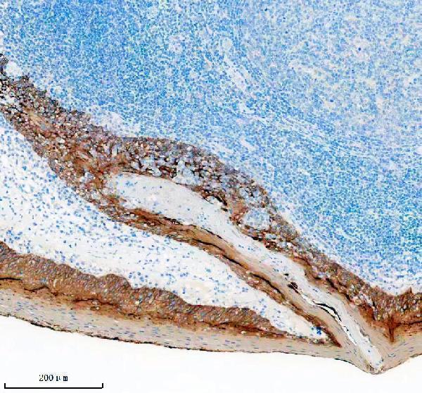 m00398 2 krt5 primary antibodies ihc testing 3