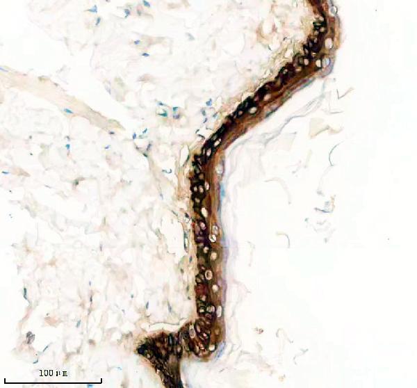 m00398 2 krt5 primary antibodies ihc testing 4
