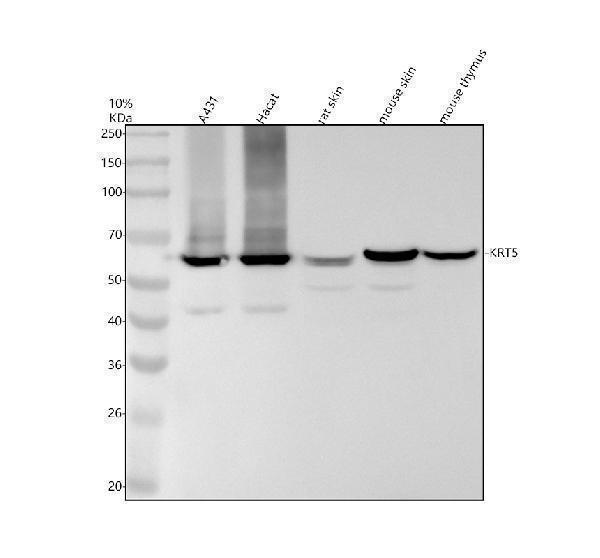 Western blot analysis of KRT5 using anti-KRT5 antibody (M00398-2)