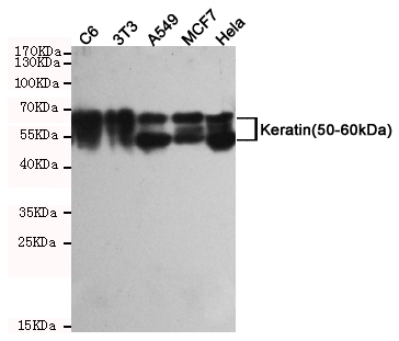 Western blot detection of Keratin (50-60kDa) in C6, 3T3, A549, MCF7 and Hela cell lysates using Keratin (50-60kDa) mouse mAb (1:2000 diluted)
