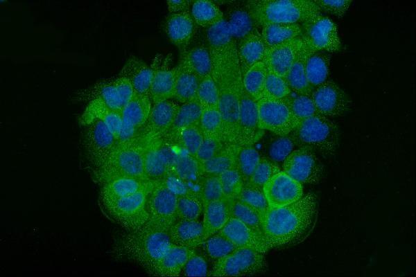 m00398 6 krt5 primary antibodies if testing 5